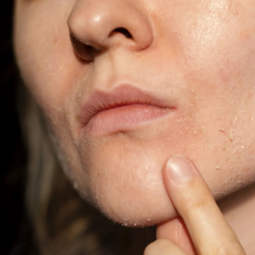 Suchá pleť - balení - 200 ml