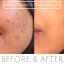 Jane Scrivner Brightening B Ceramide Boost - projasňující sérums niacinamidem