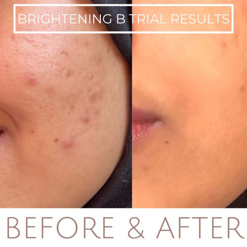 Jane Scrivner Brightening B Ceramide Boost - projasňující sérums niacinamidem