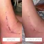 Jane Scrivner Scar drops - olej na jizvy